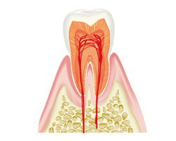 健康な歯の状態